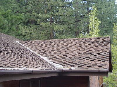 shingles